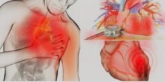 أعراض جلطة القلب , أعراض النوبة القلبية و طرق الوقاية منها